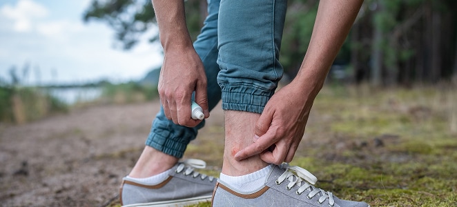 Insect Bites and Stings