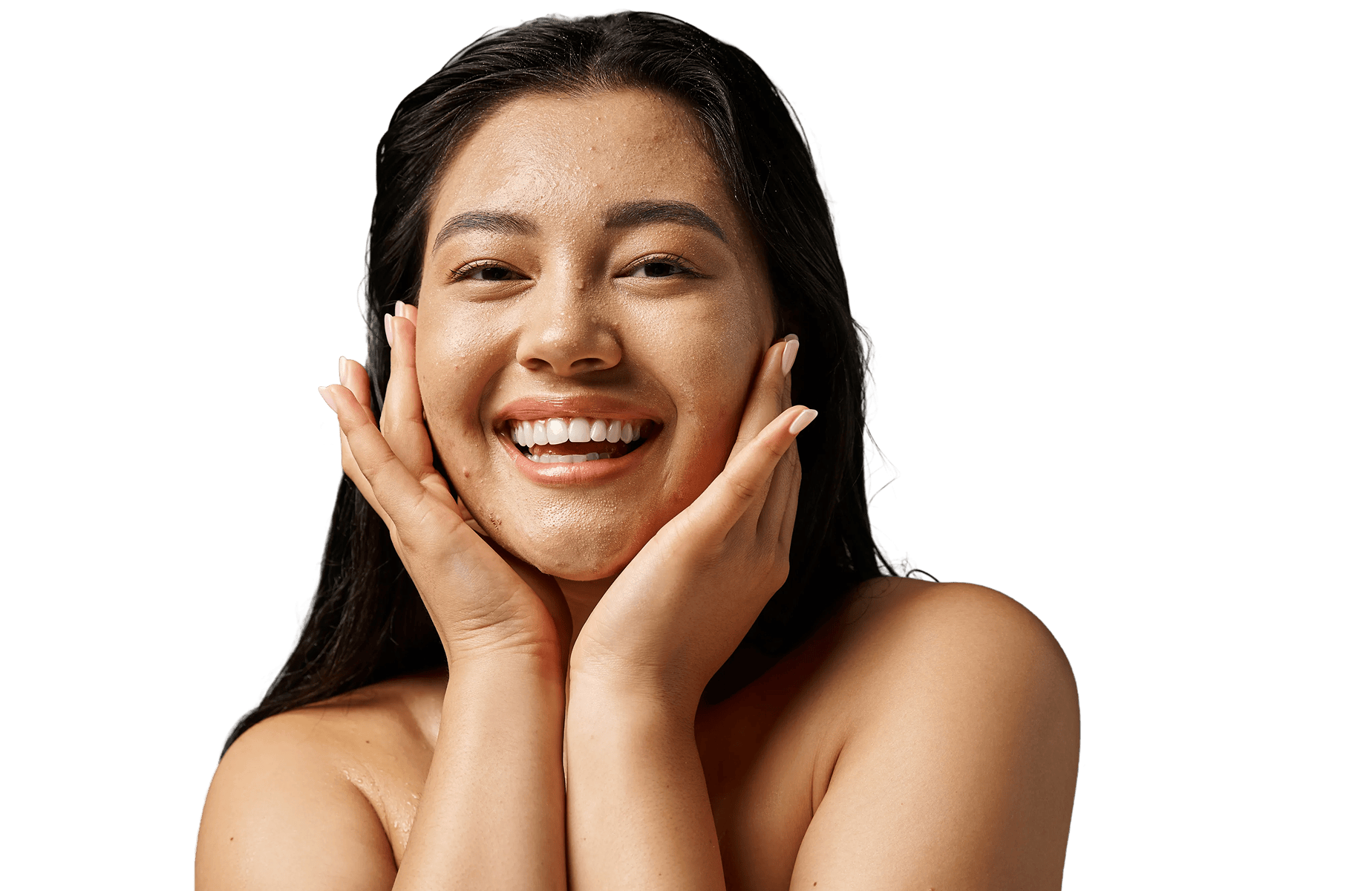 All About Acne