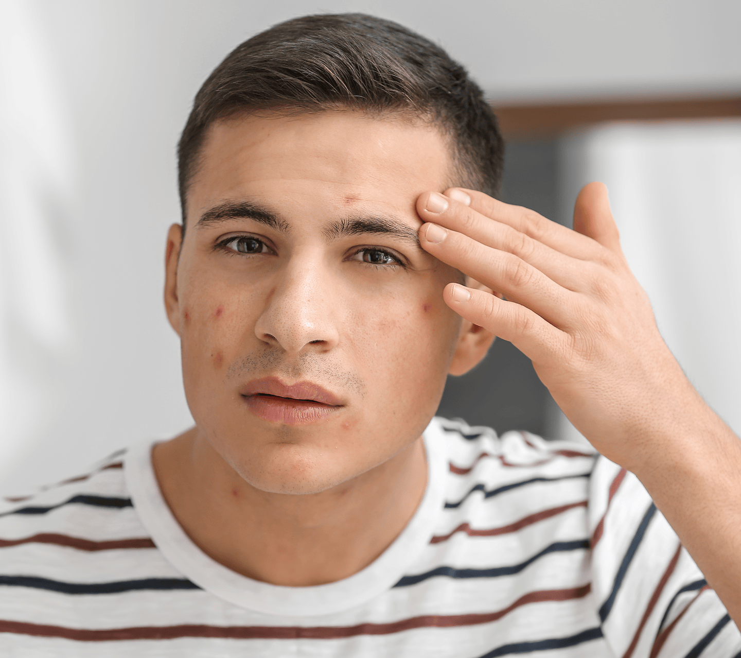 Comedonal acne