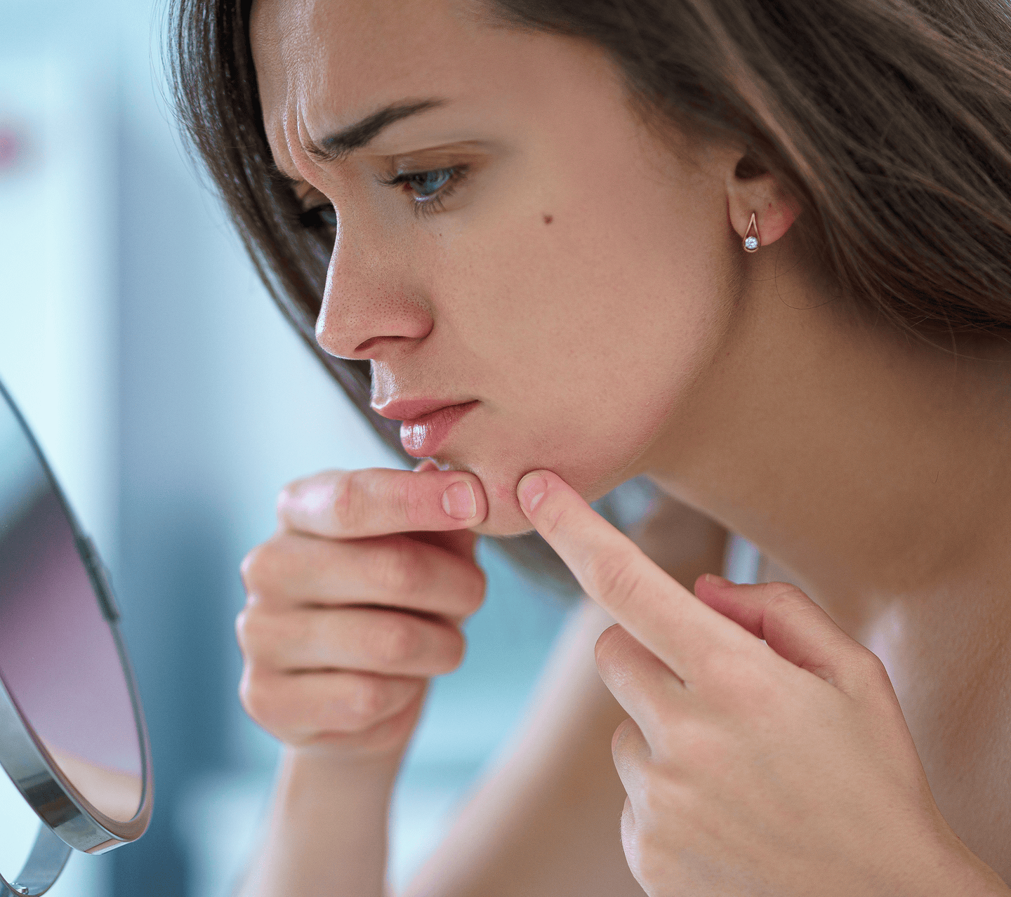 Cystic acne